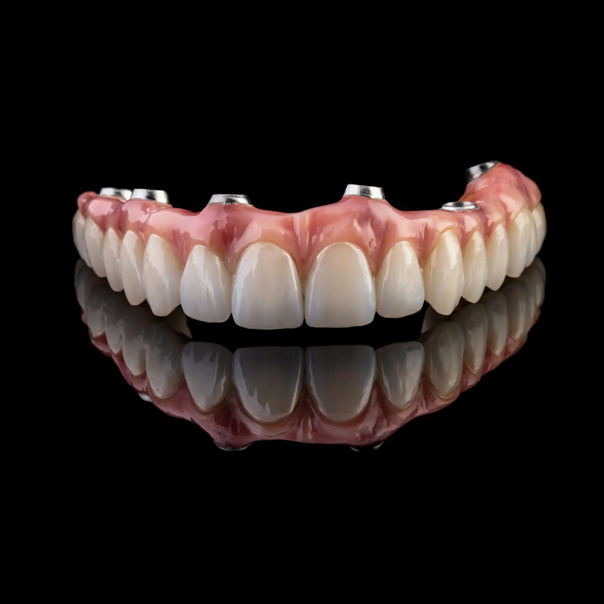 Patient smiling after implants