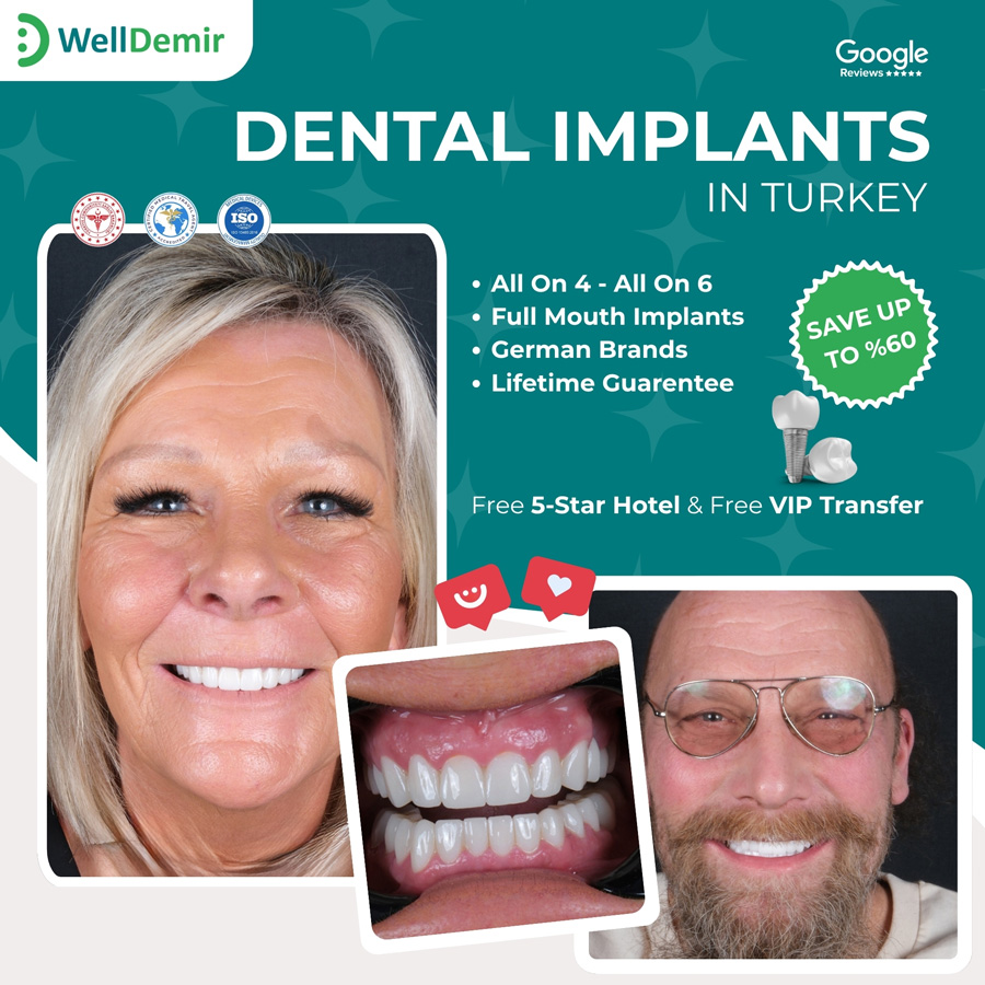 Patient smiling after implants